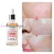 Сироватка для проблемної шкіри обличчя Top Beauty Anti Acne Serum TBAA-5829 фото 2