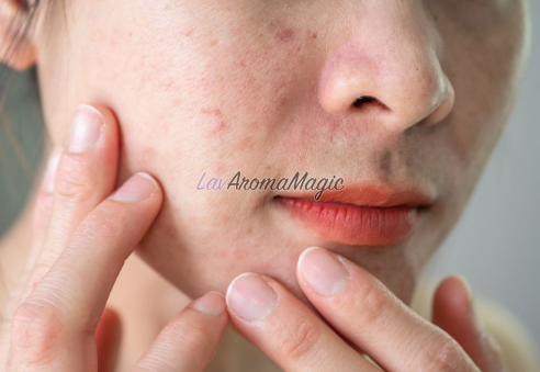 Тонік для проблемної шкіри обличчя Top Beauty Anti Acne TBAA-T-3939 фото