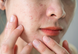 Тонік для проблемної шкіри обличчя Top Beauty Anti Acne TBAA-T-3939 фото 3
